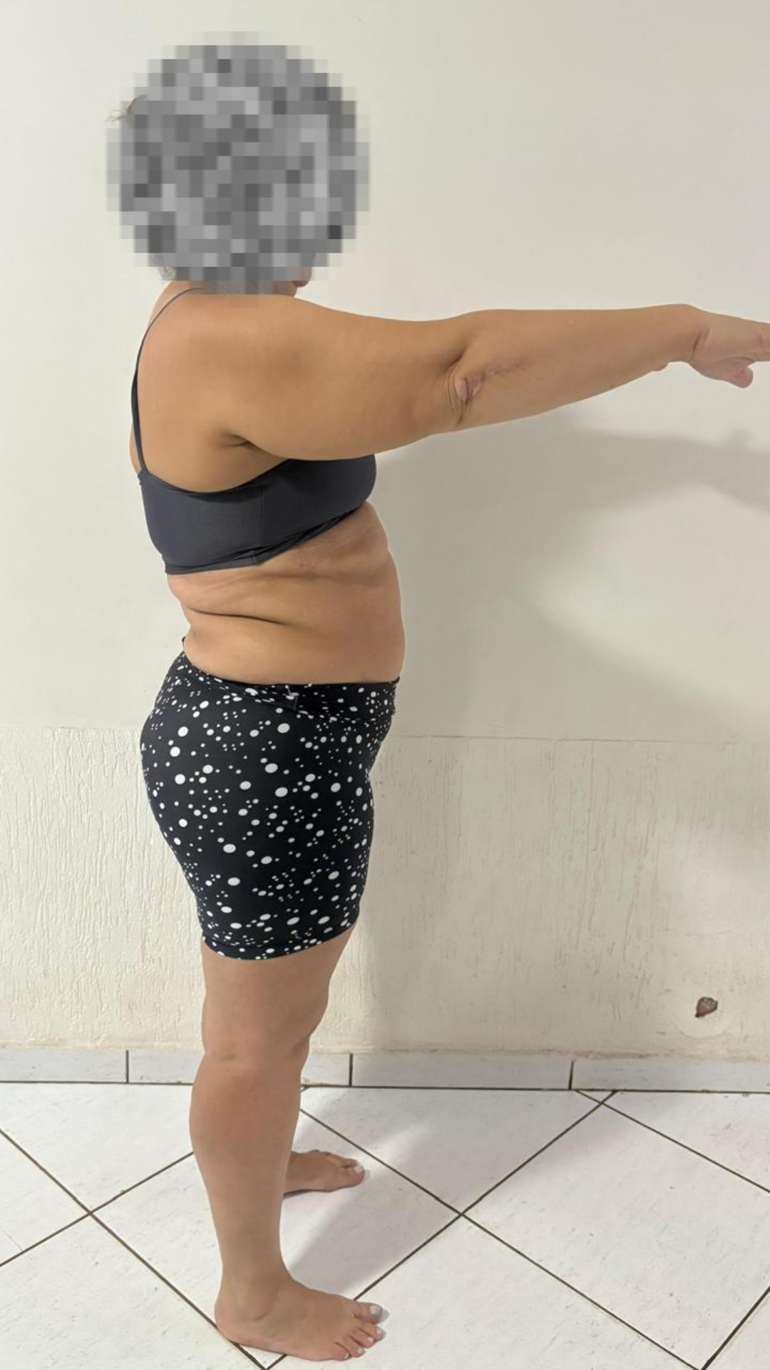 Antes — Perfil